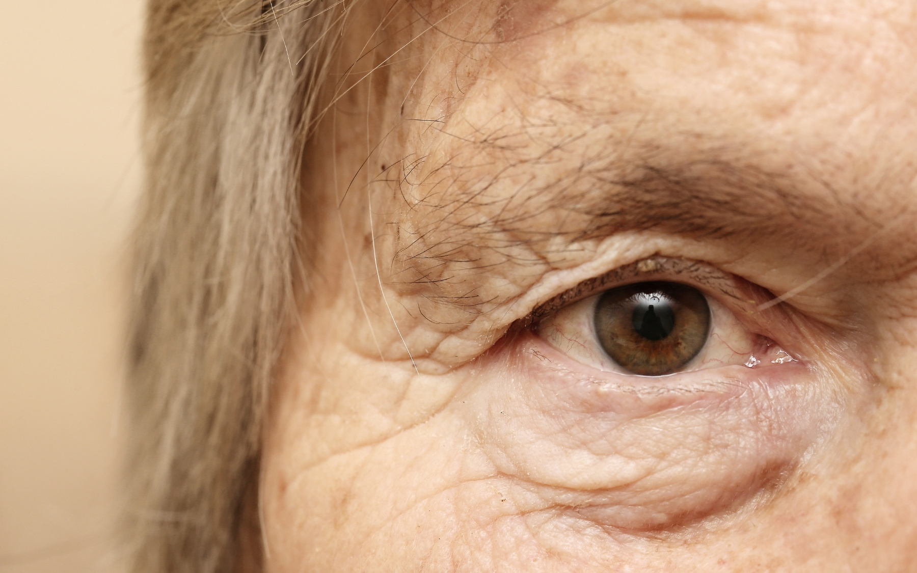 glaucoma a deep dive in to an older woman eye