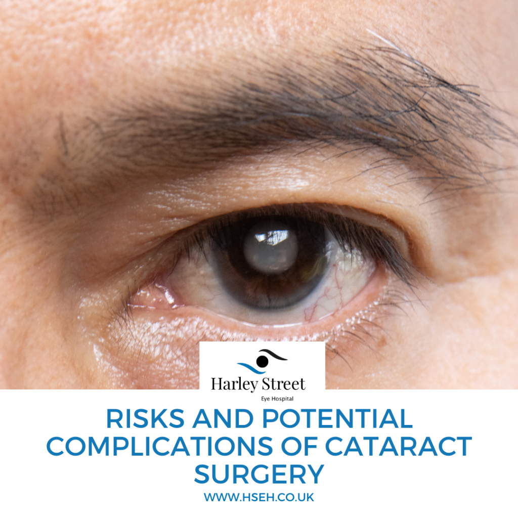 Risks and potential complications of cataract surgery - HSEH