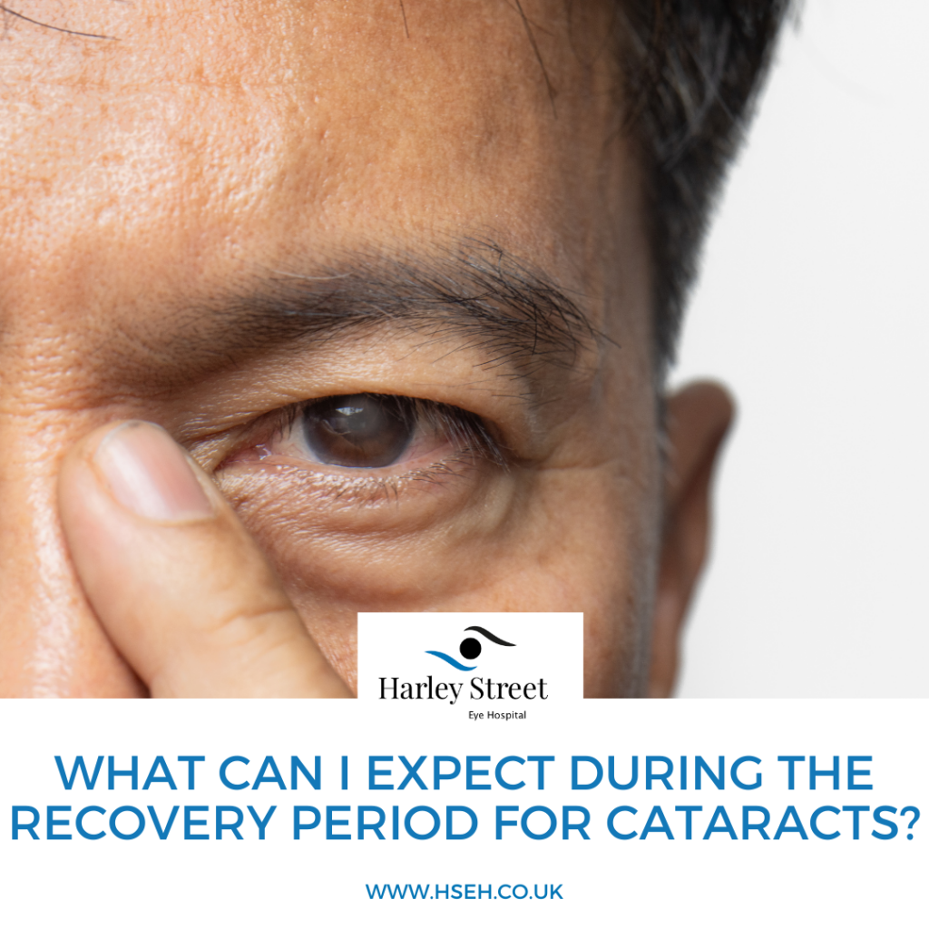 What can I expect during the recovery period for cataracts? - HSEH